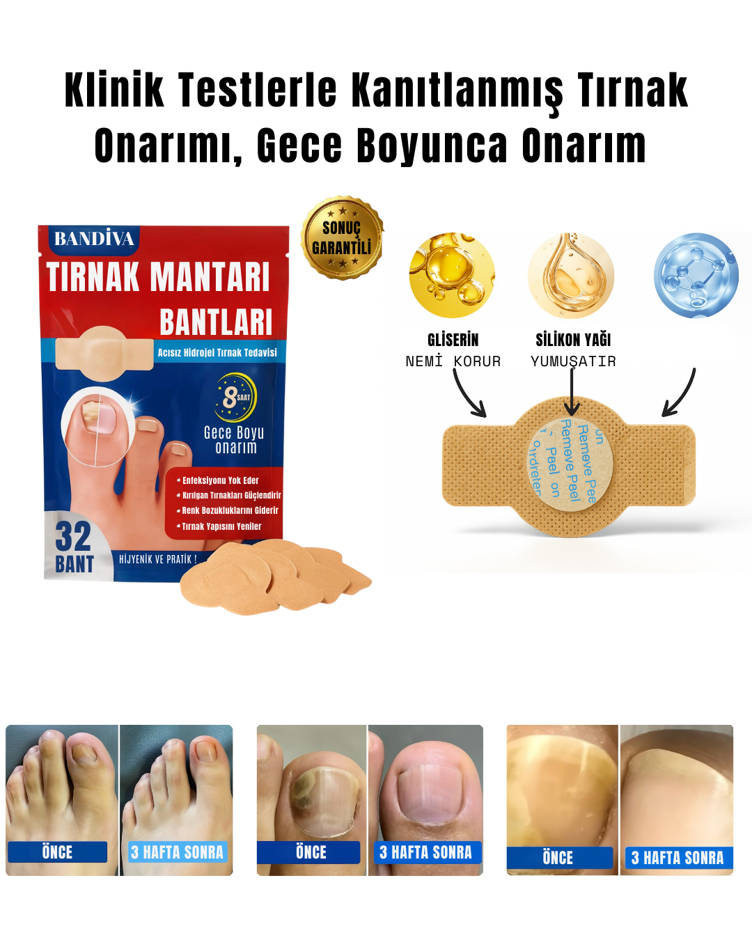 BANDİVA TIRNAK MANTARI BANTLARI